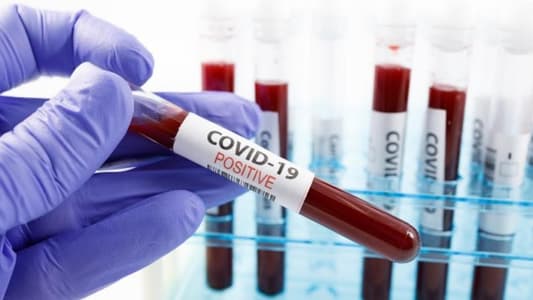 Covid-19 Could Become Seasonal Flu Instead of Being Eradicated, Experts Say
