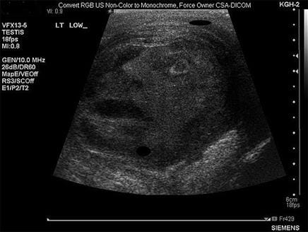 طبيب لبناني من كندا يتحدث عن صورة بالأشعة ظهر فيها "وجه بشري" للسرطان