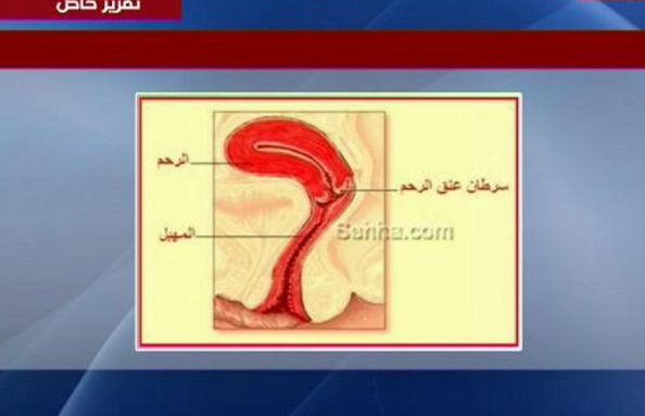 في أي عمر يفترض إعطاء الفتيات لقاح سرطان عنق الرحم؟