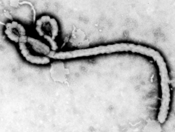 African Union calls for Ebola travel bans to be lifted