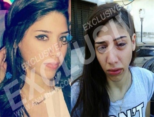 Girl Comes under Acid Attack in Sarba