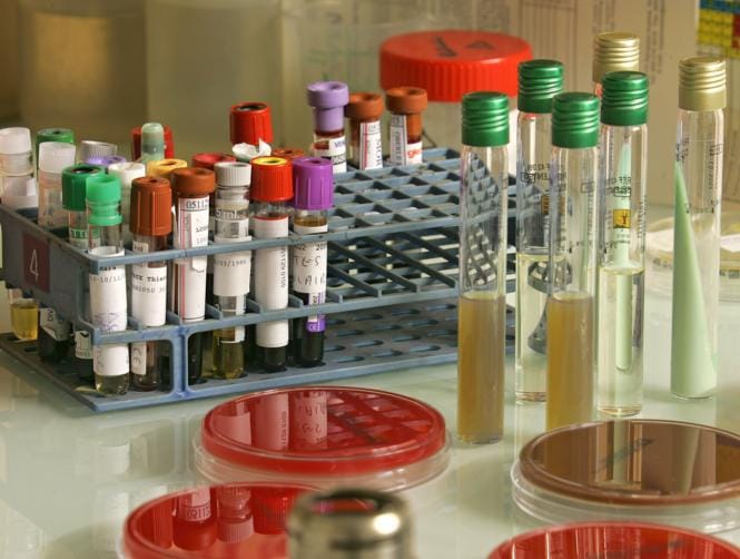 ارتفاع مستوى السكر في الدم قد يسبب السرطان