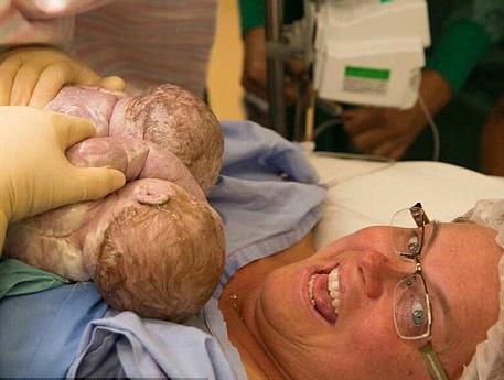 بالصور: وّلدت نفسها في عمليّة قيصرية!