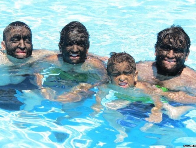 It's Not Easy Being The Hairiest Family in Human History 