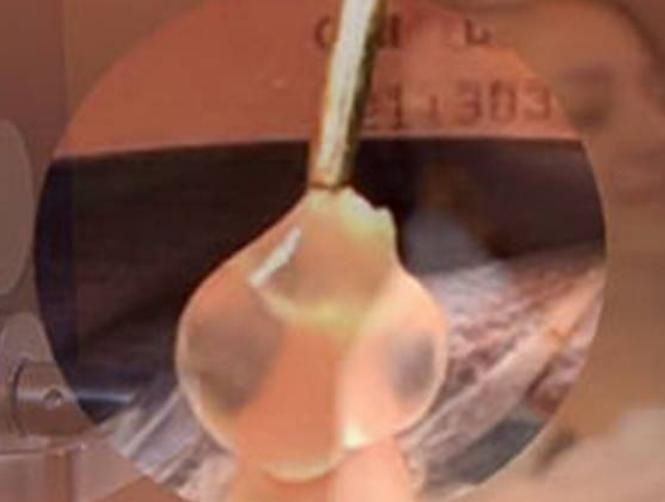 Horrifying Parasite Found Living in a Woman's Brain 