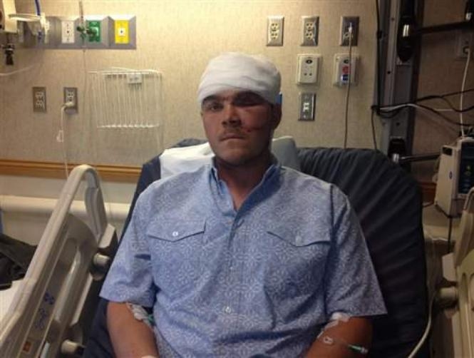 Man Shoves Arm Down Bear's Throat to Escape Attack