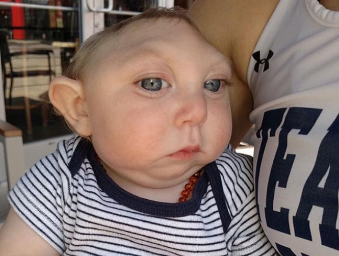 Footage: Miracle Baby Jaxon with Half Skull Says 'Hello'