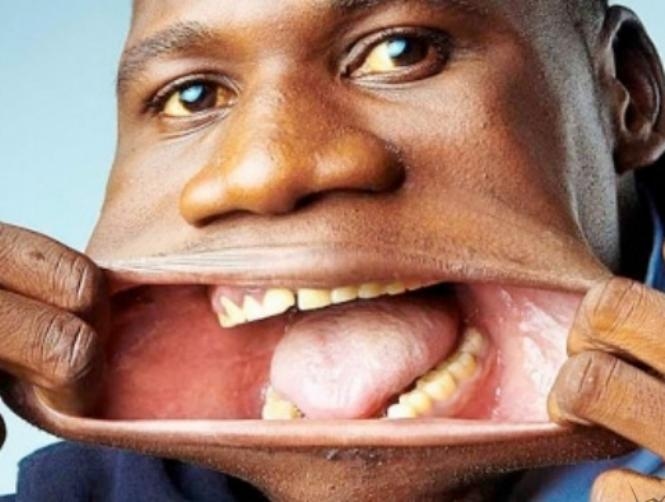 بالصور: تعرّفوا على صاحب أكبر فم