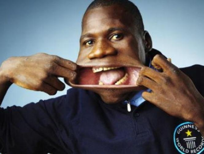 بالصور: تعرّفوا على صاحب أكبر فم