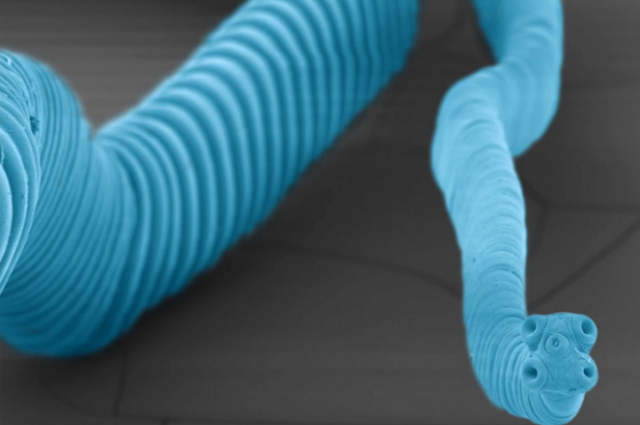 Man Dies after He Contracts Cancer from Parasitic Worm