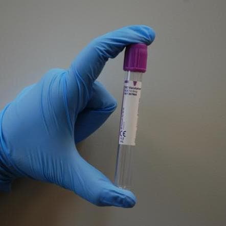 Scientists develop One-Step Test for Hepatitis C 
