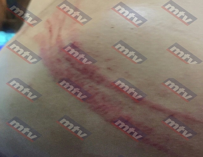 بالصور: بعد أن قبّل قدمها شوّه جسدها