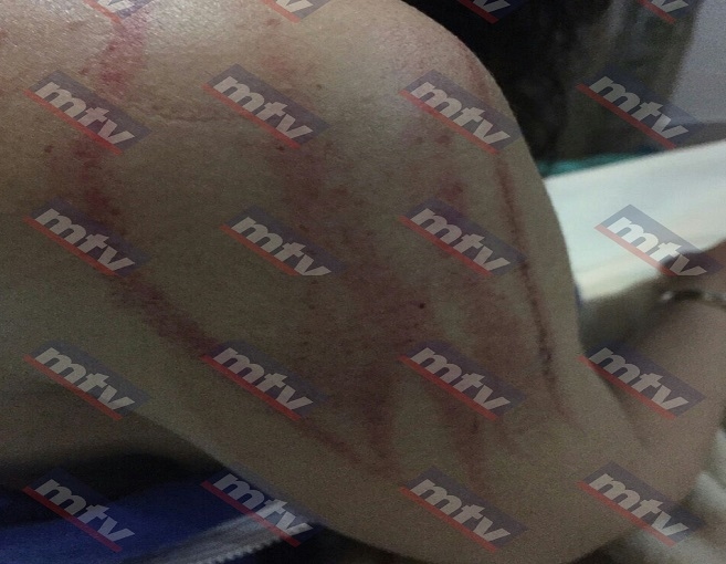 بالصور: بعد أن قبّل قدمها شوّه جسدها