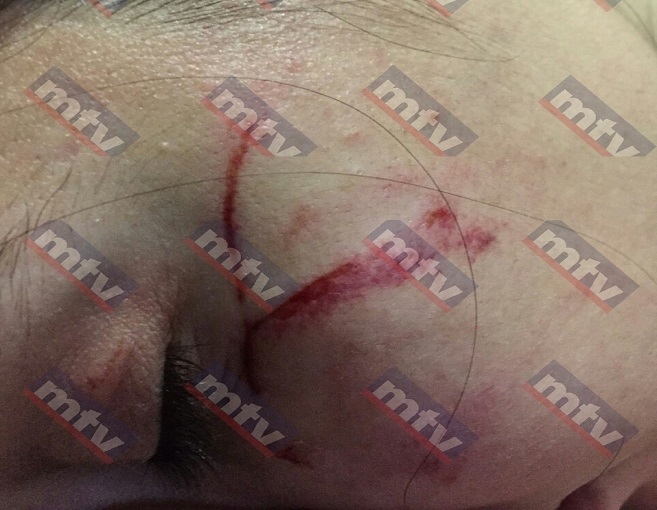 بالصور: بعد أن قبّل قدمها شوّه جسدها