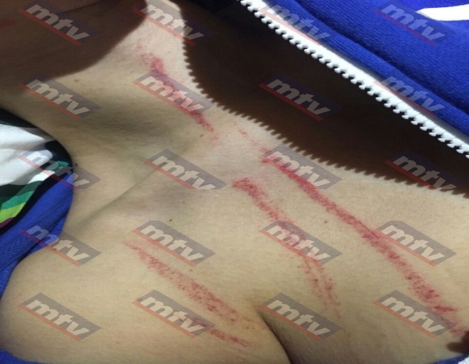 بالصور: بعد أن قبّل قدمها شوّه جسدها