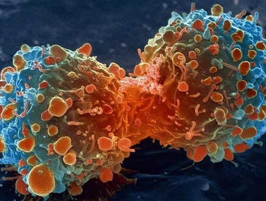 Researchers Discover New Form of Contagious Cancer