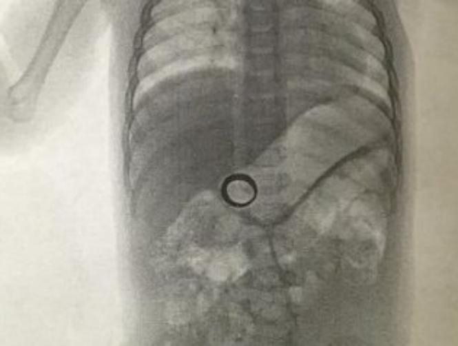 لن تصدّقوا أين وجدت خاتمها الضائع