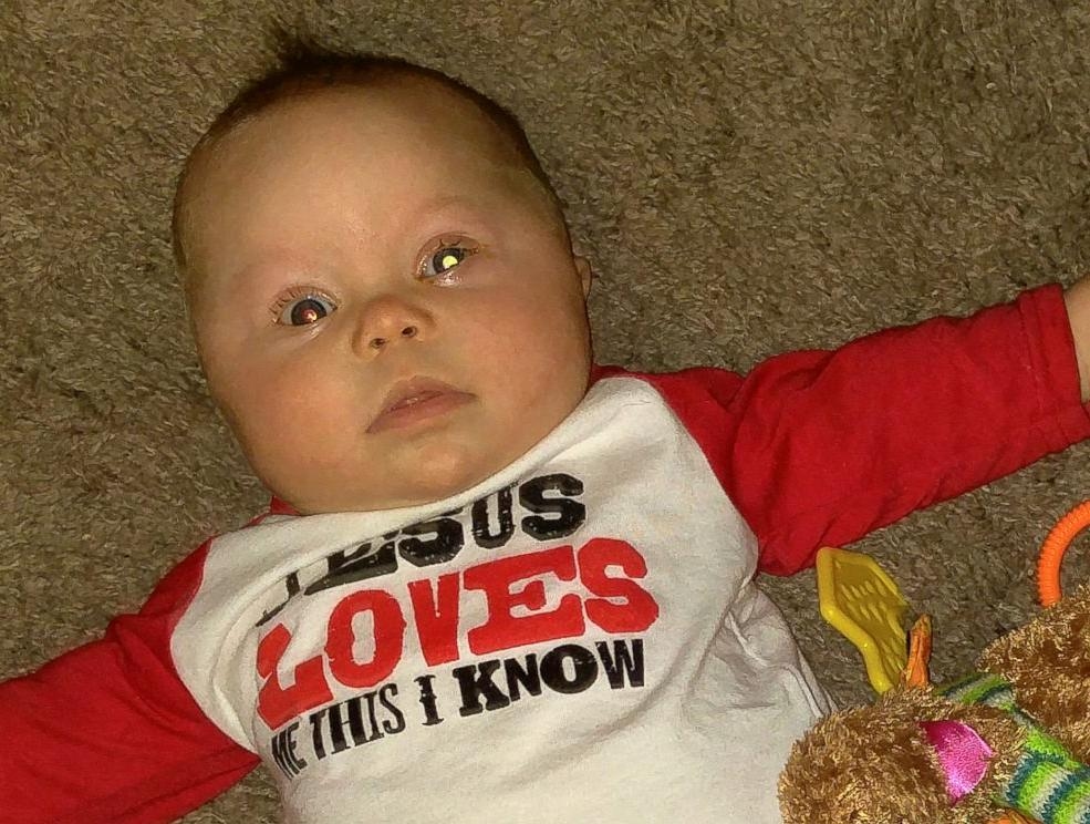 Camera Flash Detects Eye Cancer, Saves Baby's Life