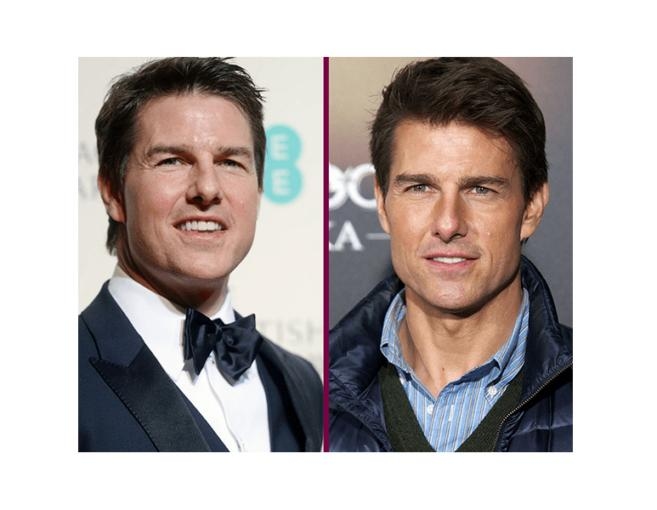 بالصورة: توم كروز في تجربته الأولى مع البوتوكس