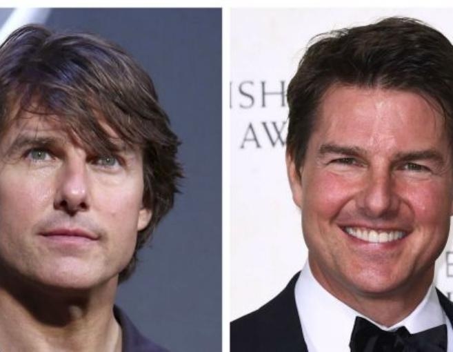 بالصورة: توم كروز في تجربته الأولى مع البوتوكس