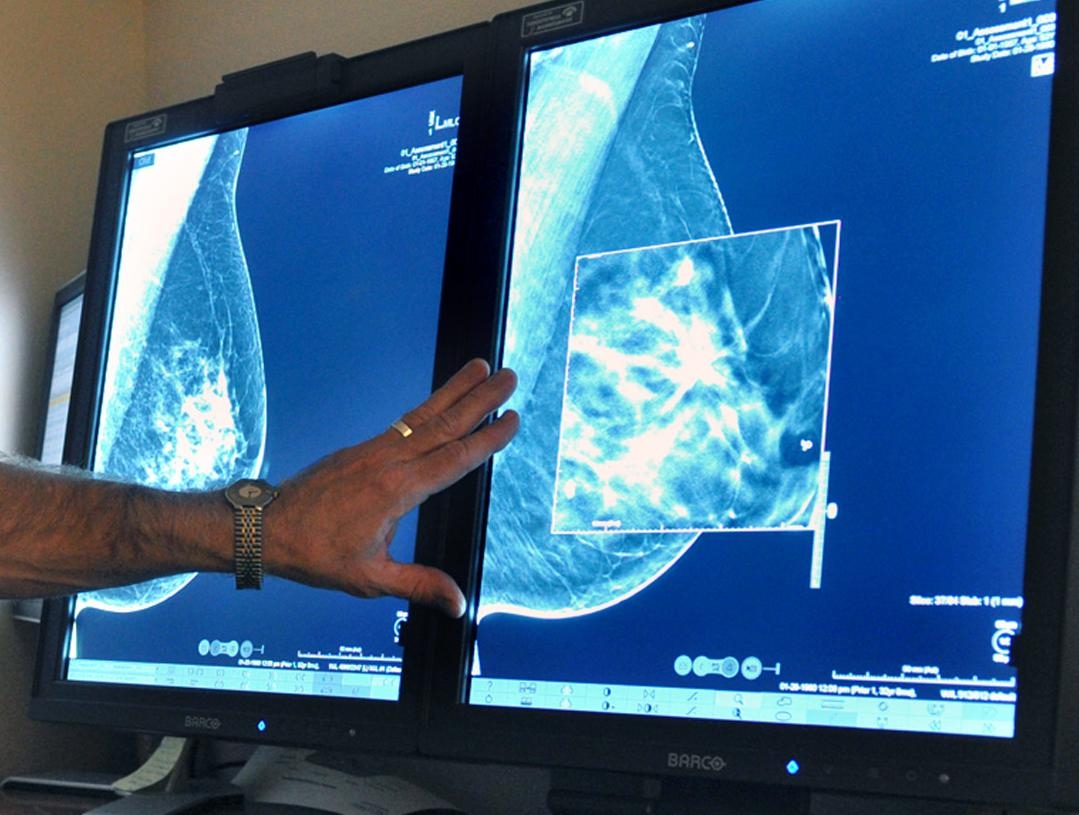 Main Highlight Image