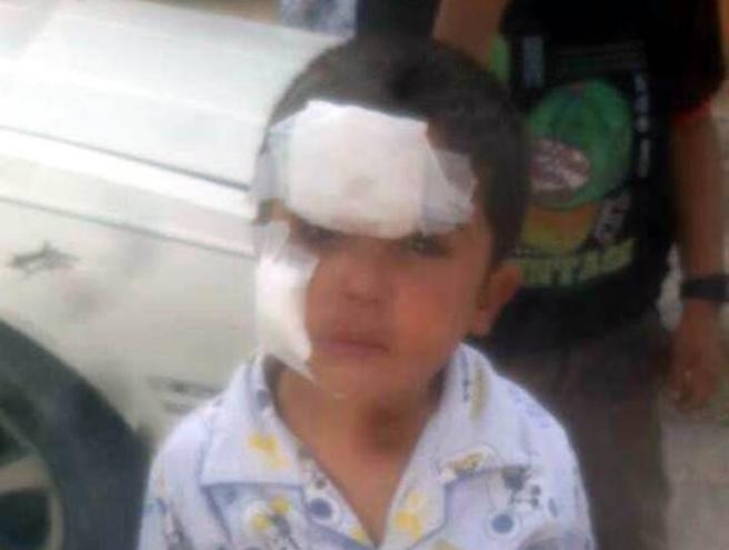 بالصور: كلب شرس يتسبب بجرح 5 اطفال