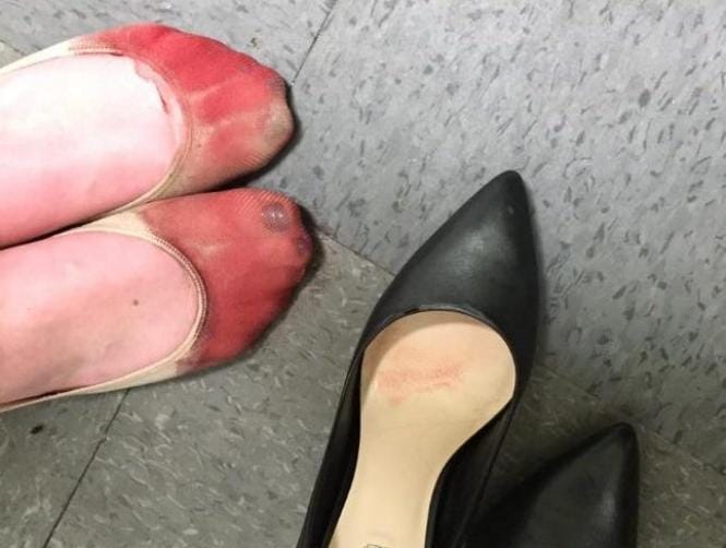 Photo: Bleeding Feet Highlight 'Unfair' Work High Heel Policy