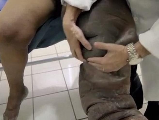بالصورة: "لدغة" حوّلته إلى فيل!