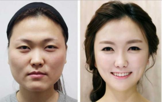 Five of The Most Surprising Plastic Surgery Hotspots