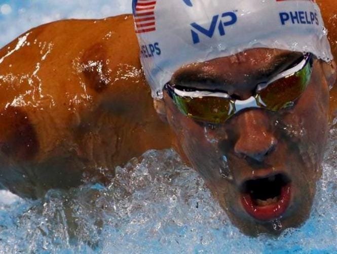 Photos: What Is ‘Cupping’ and Why Are Olympic Athletes Doing It?