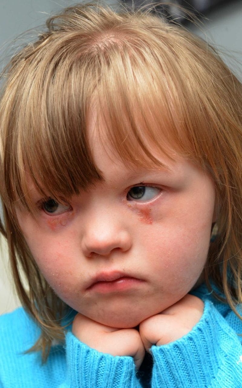 Stranger Attacks and Throws Girl with Down Syndrome into the Street