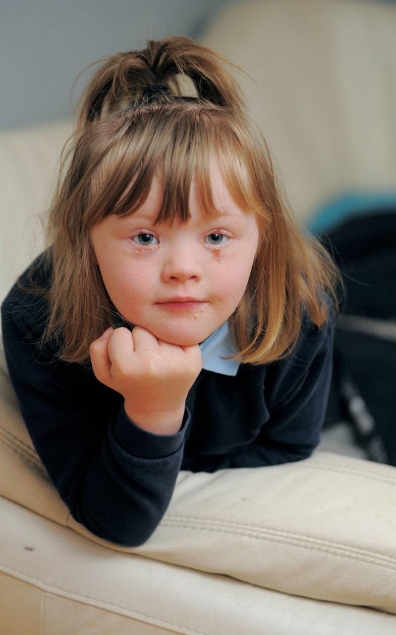 Stranger Attacks and Throws Girl with Down Syndrome into the Street