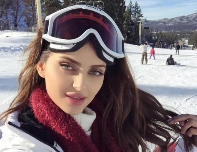 النجم التركي يصفع العارضة من أجل خطيبته