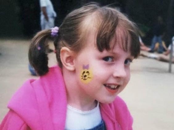 This Woman Is Growing a Second Skeleton - and It's Locking Her inside Her Own Body