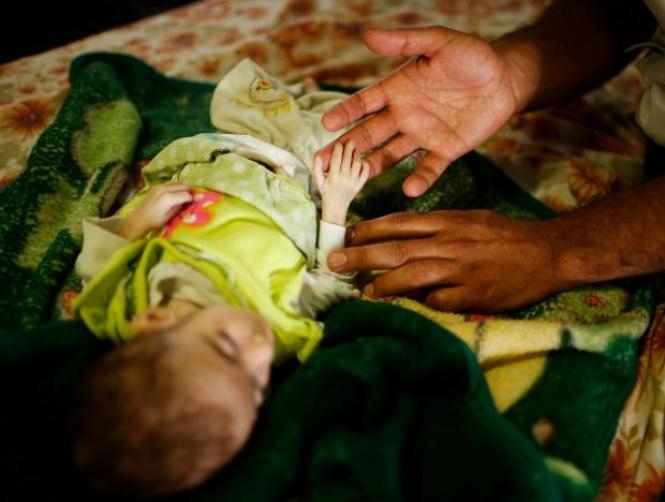 Main Highlight Image