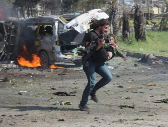 Photos: Photographer Who Rescued Child From Aleppo Bus Bombing Speaks Out