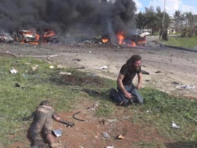 Photos: Photographer Who Rescued Child From Aleppo Bus Bombing Speaks Out