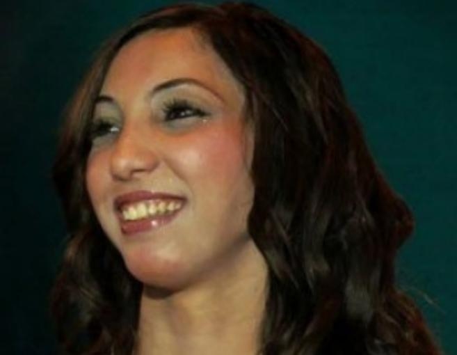 بالصور: دنيا بطمة قبل التجميل وبعده