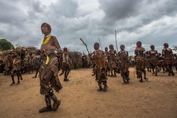 بالصور: تتوسّله لجلدها.. وأكثر