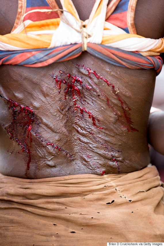 بالصور: تتوسّله لجلدها.. وأكثر