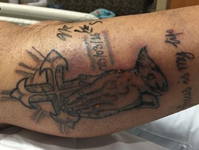 Photos: Danger of Swimming With New Tattoo Revealed After Man Dies From Infection