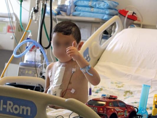 أول جراحة ناجحة لزراعة قلب عند الأطفال في لبنان