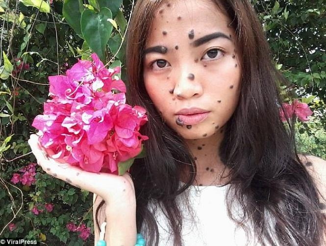 Photos: Woman Bullied for Her Moles Could Be Crowned Next Miss Universe