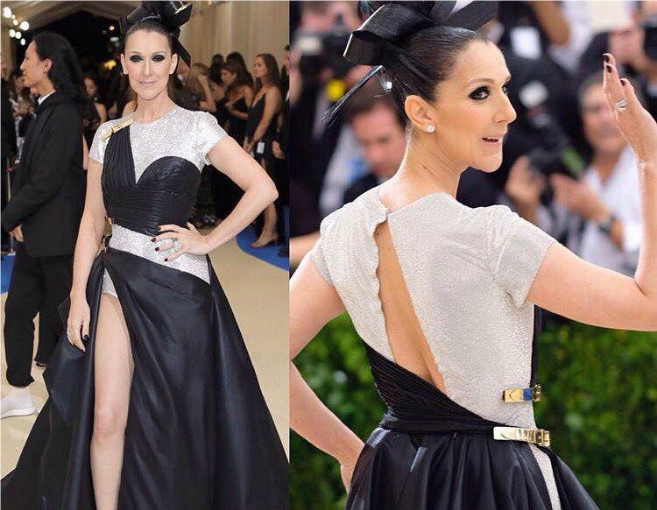 بالصور: لماذا تعرّت سيلين كلياً بعد وفاة زوجها؟