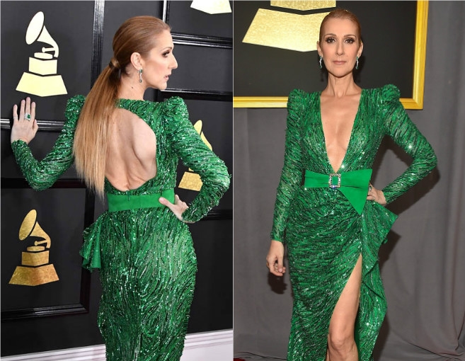 بالصور: لماذا تعرّت سيلين كلياً بعد وفاة زوجها؟