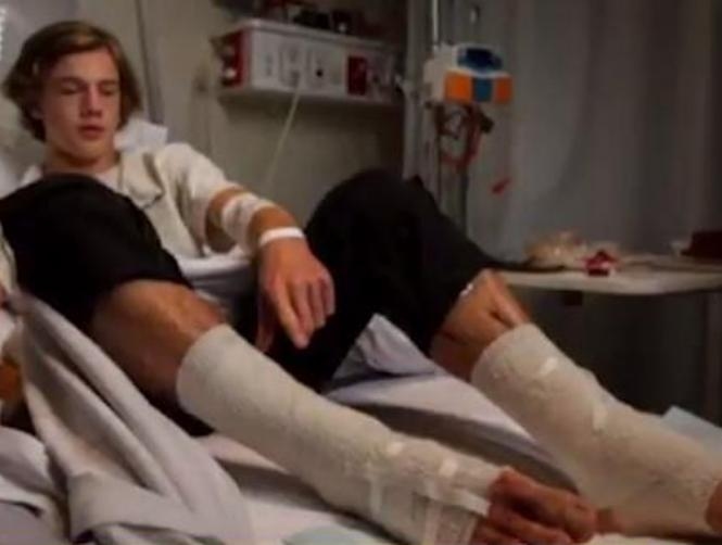 Photos: Teenage Boy's Legs Eaten by Tiny Sea Creatures