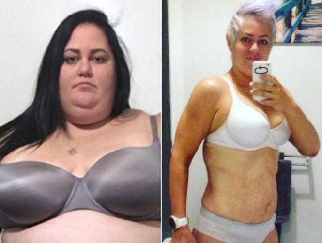 Woman Who Was Told She Would Die at 40 Reveals How She Lost 115kg