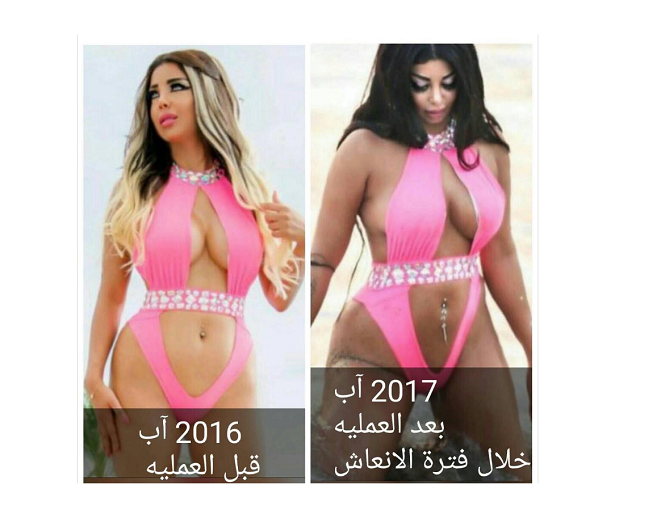 رولا يموت: شاهدوا جسدي قبل وبعد التجميل