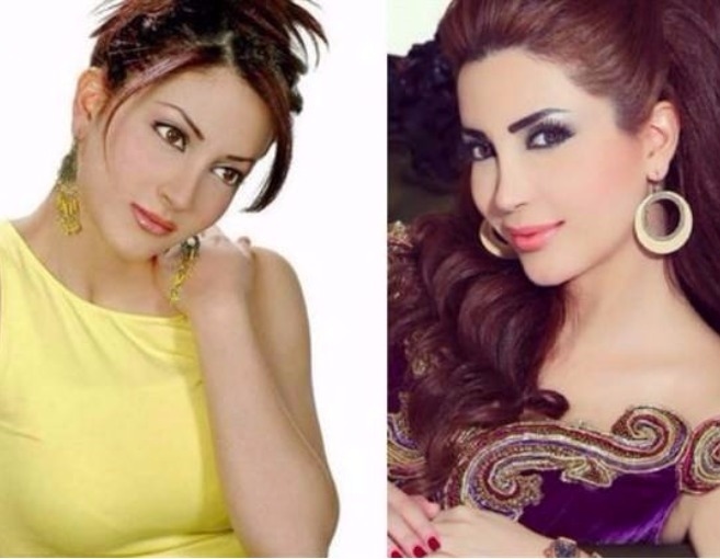 بالصورة: شاهدوا نسرين طافش قبل التجميل