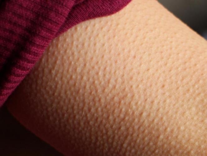 If Music Gives You Goosebumps, Your Brain Might Be Special